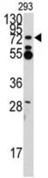 Anti-ZFP219 antibody, N-term used in Western Blot (WB). GTX82519