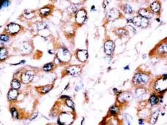 Anti-HDBP2 antibody, Internal used in IHC (Paraffin sections) (IHC-P). GTX82520