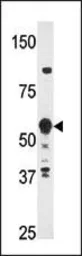 Anti-HDBP2 antibody, Internal used in Western Blot (WB). GTX82520