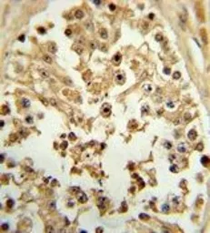 Anti-eIF4E antibody used in IHC (Paraffin sections) (IHC-P). GTX82525
