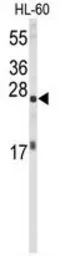 Anti-eIF4E antibody used in Western Blot (WB). GTX82525