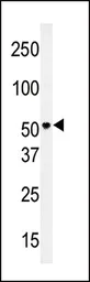 Anti-SLC29A4 antibody, N-term used in Western Blot (WB). GTX82547