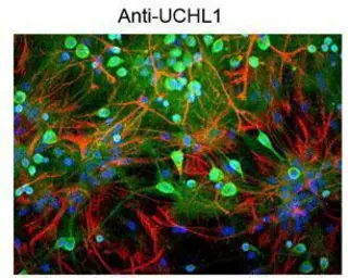 Anti-PGP9.5 antibody used in Immunocytochemistry/ Immunofluorescence (ICC/IF). GTX82567