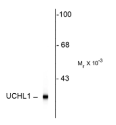 Anti-PGP9.5 antibody [BH7] used in Western Blot (WB). GTX82568