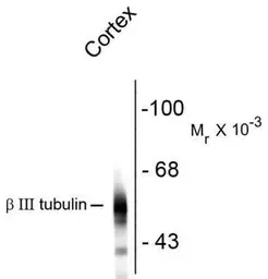 Anti-beta Tubulin 3/ Tuj1 antibody [AA10] used in Western Blot (WB). GTX82572