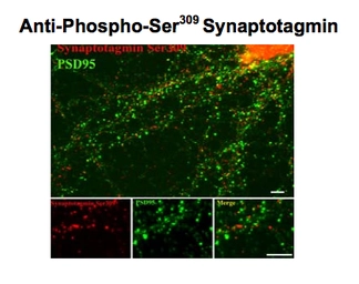Anti-Synaptotagmin 1 (phospho Ser312) + Synaptotagmin 2 (phospho Ser309) antibody used in Immunohistochemistry (IHC). GTX82583