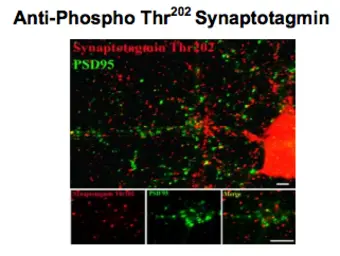 Anti-Synaptotagmin 1 (phospho Thr202) + Synaptotagmin 2 (phospho Thr199) antibody used in Immunohistochemistry (IHC). GTX82584