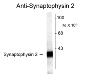 Anti-SYNPR antibody used in Western Blot (WB). GTX82586