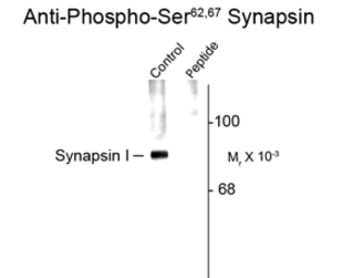 Anti-Synapsin I (phospho Ser62/67) antibody used in Western Blot (WB). GTX82591