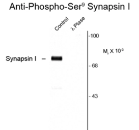 Anti-Synapsin I (phospho Ser9) antibody used in Western Blot (WB). GTX82592