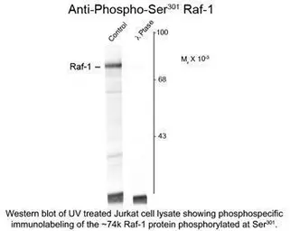 Anti-Raf1 (phospho Ser301) antibody used in Western Blot (WB). GTX82602