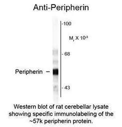 Anti-Peripherin antibody used in  (). GTX82613