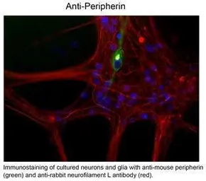 Anti-Peripherin antibody [7C5] used in Immunohistochemistry (IHC). GTX82614