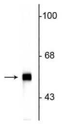 Anti-Peripherin antibody [7C5] used in Western Blot (WB). GTX82614