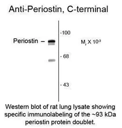 Anti-Periostin antibody, C-Term used in  (). GTX82616