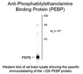 Anti-RKIP antibody used in Western Blot (WB). GTX82617