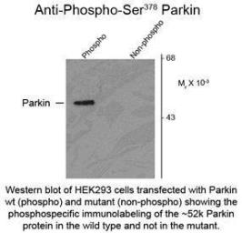 Anti-Parkin (phospho Ser378) antibody used in Western Blot (WB). GTX82618