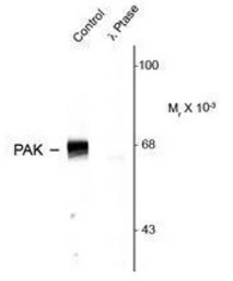 Anti-PAK1 ( phospho Thr423 ) / PAK2 ( phospho Thr402 ) / PAK3 ( phospho Thr436 ) antibody used in Western Blot (WB). GTX82619