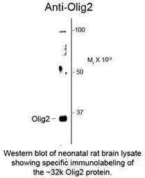 Anti-OLIG2 antibody used in Western Blot (WB). GTX82620