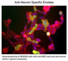 Anti-NSE antibody used in Immunohistochemistry (IHC). GTX82623