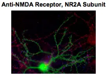 Anti-NMDAR2A antibody, N-Term used in Immunocytochemistry/ Immunofluorescence (ICC/IF). GTX82634