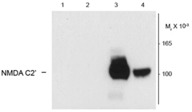 Anti-NMDAR1 (splice variant C2') antibody used in Western Blot (WB). GTX82638