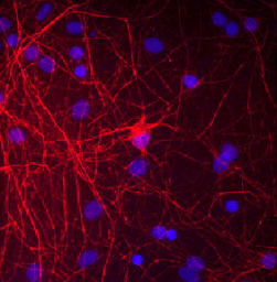 Anti-NF-M antibody used in Immunocytochemistry/ Immunofluorescence (ICC/IF). GTX82642