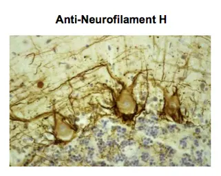 Anti-NF-H antibody [NAP4] used in Immunocytochemistry/ Immunofluorescence (ICC/IF). GTX82647