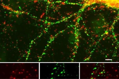 Anti-Munc18 (phospho Ser513) antibody used in Immunocytochemistry/ Immunofluorescence (ICC/IF). GTX82649
