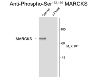 Anti-MARCKS (phospho Ser152/156) antibody used in Western Blot (WB). GTX82659