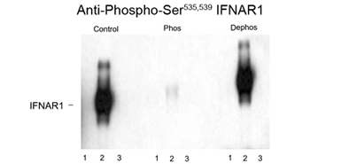 Anti-IFNAR1 (phospho Ser535/Ser539) antibody used in Western Blot (WB). GTX82662
