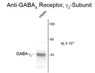 Anti-GABA A Receptor gamma 2 antibody used in Western Blot (WB). GTX82676