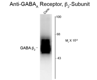 Anti-GABA A Receptor beta 2 antibody used in Western Blot (WB). GTX82682