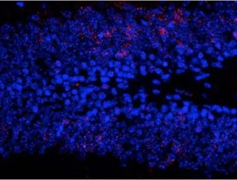 Anti-ERK1 (phospho Thr202/Tyr204) + ERK2 (phospho Thr185/Tyr187) antibody used in IHC (Paraffin sections) (IHC-P). GTX82696