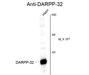 Anti-DARPP-32 antibody used in Western Blot (WB). GTX82715