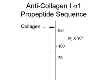 Anti-COL1A1 antibody used in Western Blot (WB). GTX82721
