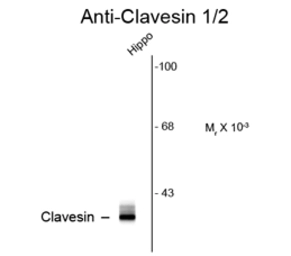 Anti-Clavesin antibody used in Western Blot (WB). GTX82723