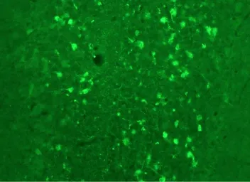 Anti-Calretinin antibody used in IHC (Frozen sections) (IHC-Fr). GTX82731