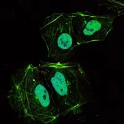 Anti-OPG antibody [5G2] used in Immunocytochemistry/ Immunofluorescence (ICC/IF). GTX82749