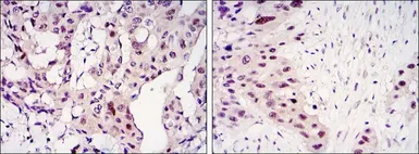 Anti-STAT3 antibody [3B5] used in IHC (Paraffin sections) (IHC-P). GTX82752