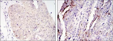Anti-TORC2 antibody [5B10] used in IHC (Paraffin sections) (IHC-P). GTX82754