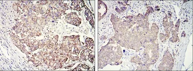 Anti-Her2 / ErbB2 antibody [6C2] used in IHC (Paraffin sections) (IHC-P). GTX82764