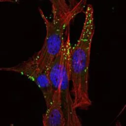 Anti-KLHL1 antibody [3A8] used in Immunocytochemistry/ Immunofluorescence (ICC/IF). GTX82766