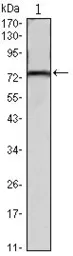 Anti-KLHL22 antibody [7B10] used in Western Blot (WB). GTX82767