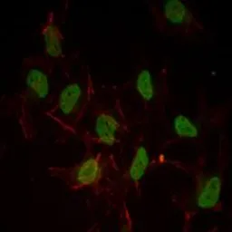 Anti-Estrogen Receptor alpha antibody [6B6] used in Immunocytochemistry/ Immunofluorescence (ICC/IF). GTX82778