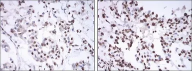 Anti-Estrogen Receptor alpha antibody [6B6] used in IHC (Paraffin sections) (IHC-P). GTX82778