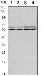 Anti-SMAD6 antibody [5H3] used in Western Blot (WB). GTX82781
