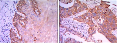 Anti-Rab25 antibody [3F12] used in IHC (Paraffin sections) (IHC-P). GTX82785