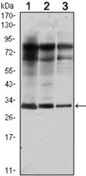 Anti-Rab25 antibody [3F12] used in Western Blot (WB). GTX82785