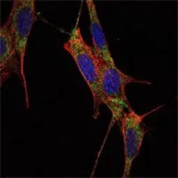 Anti-SMAD4 antibody [4G1C6] used in Immunocytochemistry/ Immunofluorescence (ICC/IF). GTX82787